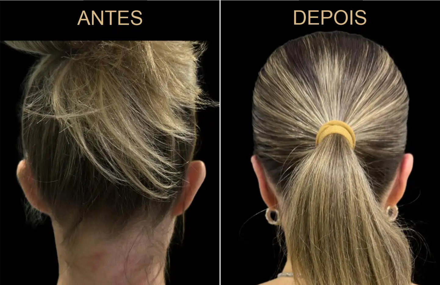 Caso 1 - Imagem 1