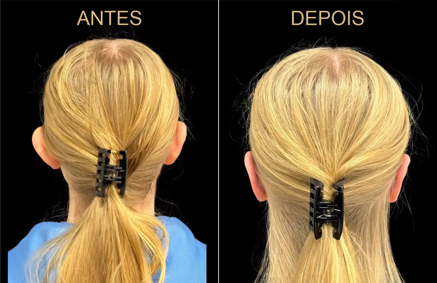 Caso 1 - Imagem 2