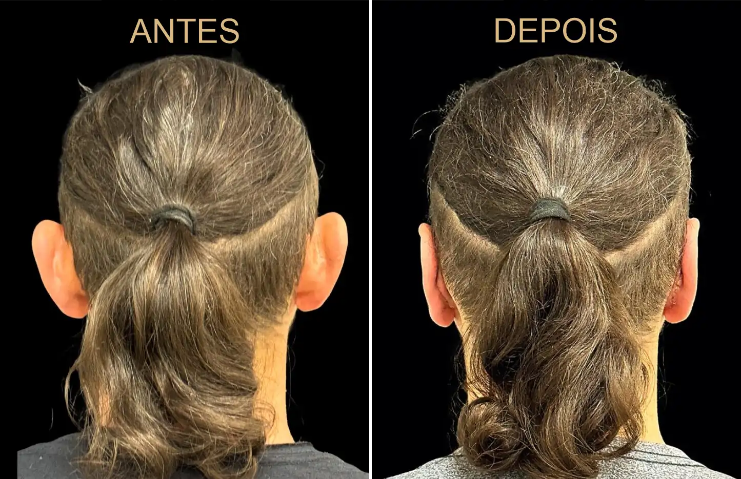 Caso 2 - Imagem 1