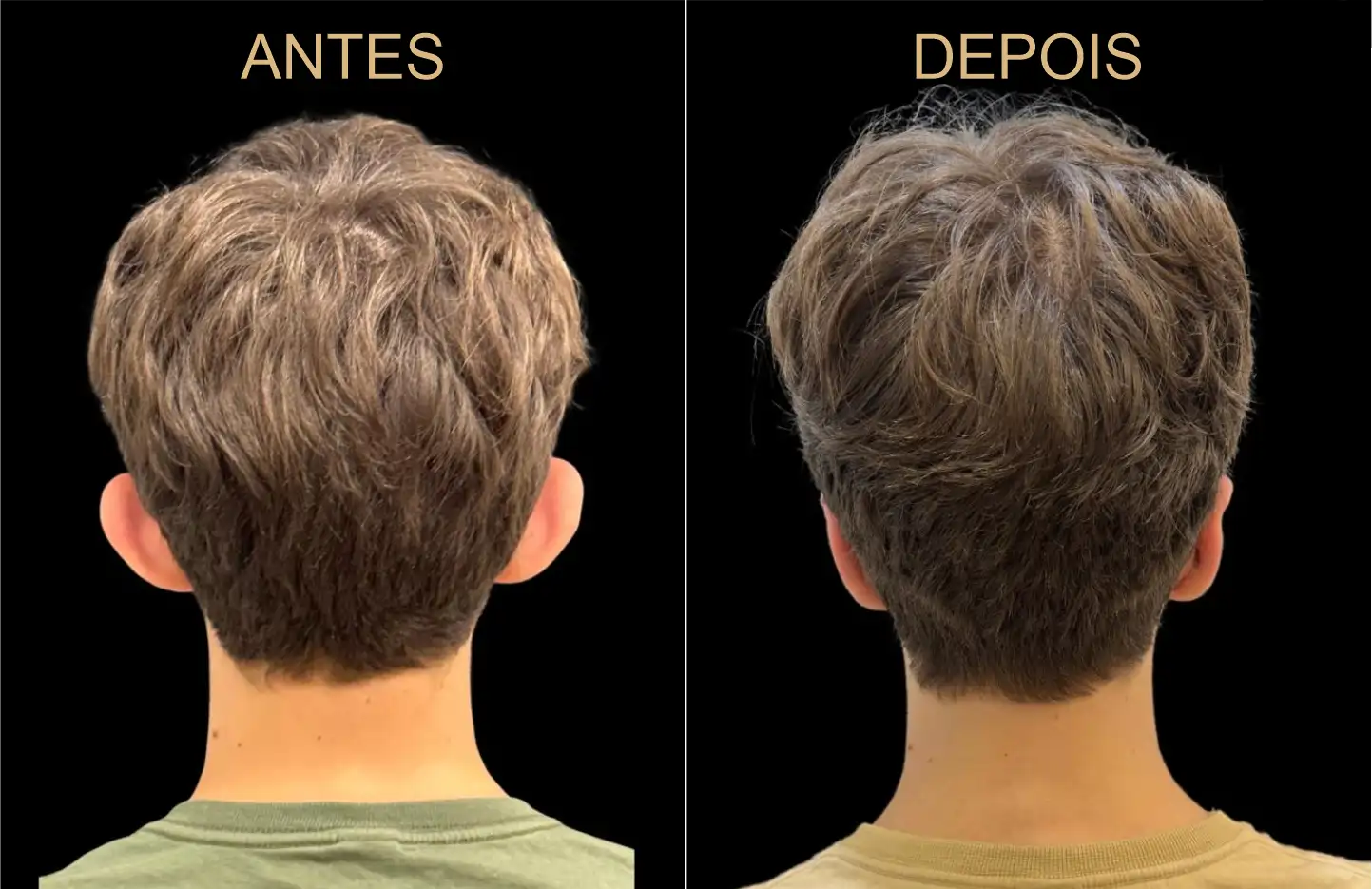 Caso 2 - Imagem 2