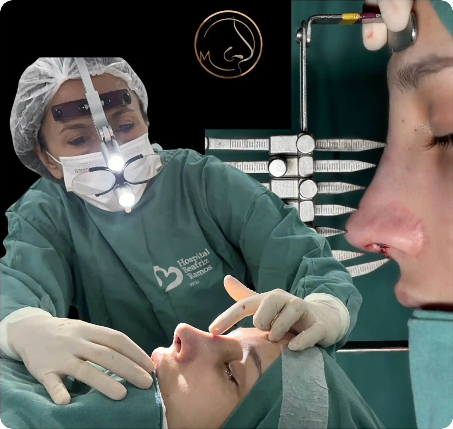 Avaliação de Rinoplastia Clínica Otomedic